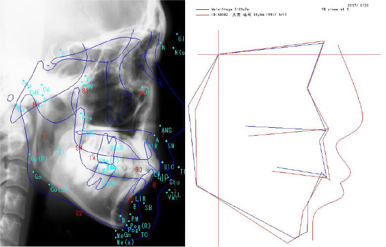 ARC(加圧機能付複模型製作フラスコ)イメージ