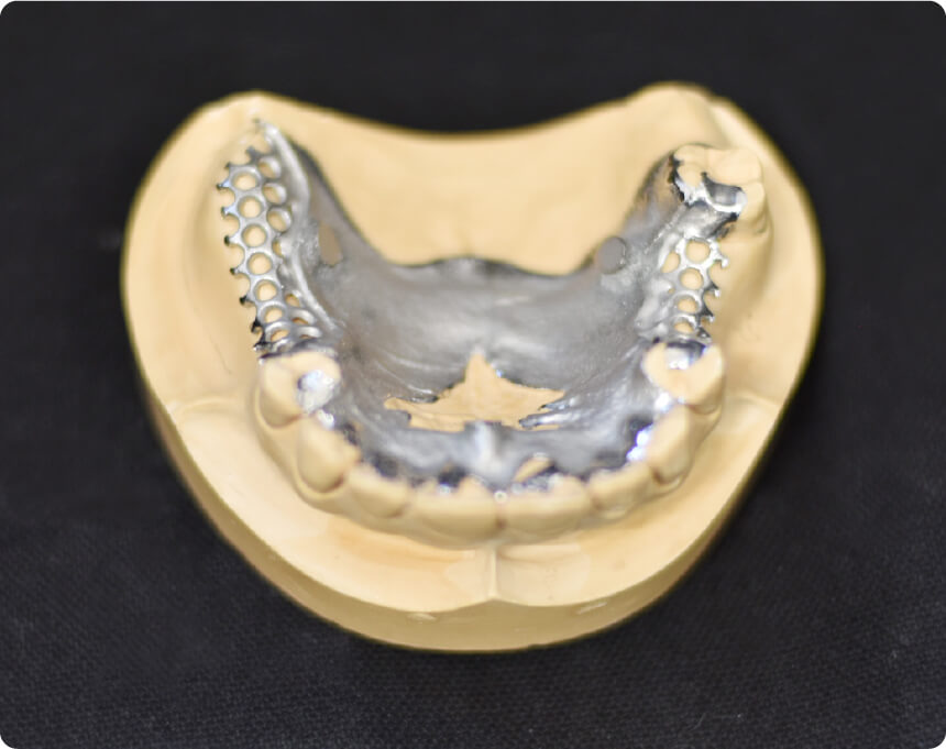 超精密デンチャー（超精密金属床）イメージ