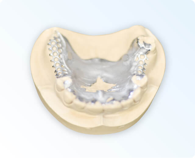 超精密デンチャーイメージ