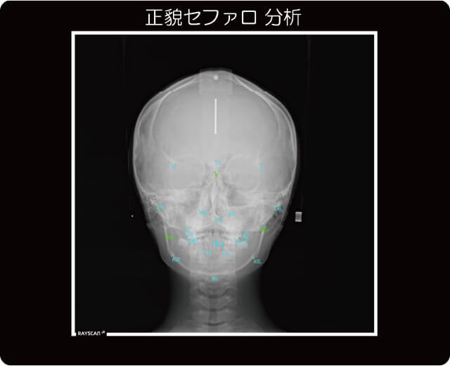 セファロ診断イメージ