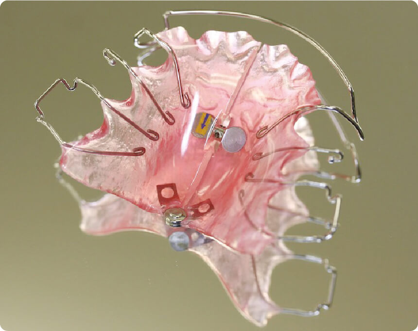 上顎用の床装置（ファンタイプ）イメージ
